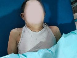 Jalan-jalan, Lansia Tiba-tiba Tewas di Pantai Malalayang